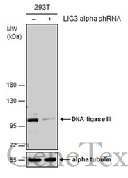 Anti-DNA ligase III antibody [C2C3], C-term used in Western Blot (WB). GTX103197