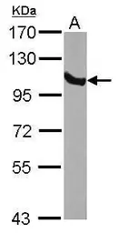 Anti-GRP94 antibody [N1N3] used in Western Blot (WB). GTX103203