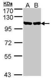 Anti-GRP94 antibody [N1N3] used in Western Blot (WB). GTX103203