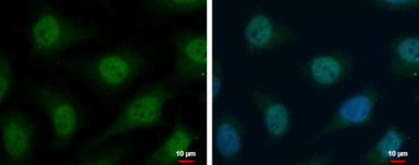 Anti-TrxR1 antibody used in Immunocytochemistry/ Immunofluorescence (ICC/IF). GTX103207