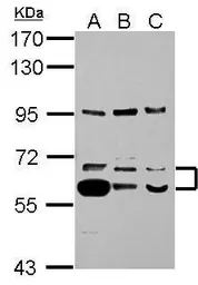 Anti-TrxR1 antibody used in Western Blot (WB). GTX103207