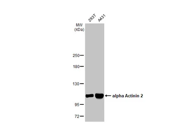 Anti-alpha Actinin 2 antibody [N1N3] used in Western Blot (WB). GTX103219