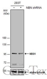 Anti-NBS1 antibody used in Western Blot (WB). GTX103229