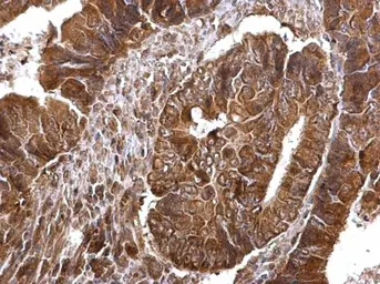 Anti-Thymidylate synthase antibody used in IHC (Paraffin sections) (IHC-P). GTX103235