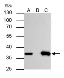 Anti-Thymidylate synthase antibody used in Immunoprecipitation (IP). GTX103235