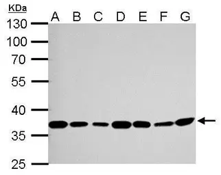 Anti-Thymidylate synthase antibody used in Western Blot (WB). GTX103235