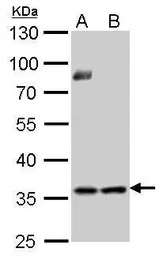 Anti-Thymidylate synthase antibody used in Western Blot (WB). GTX103235