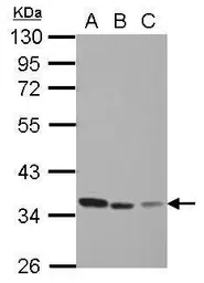 Anti-Thymidylate synthase antibody used in Western Blot (WB). GTX103235