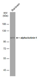 Anti-alpha Actinin 1 antibody [N2N3] used in Western Blot (WB). GTX103240