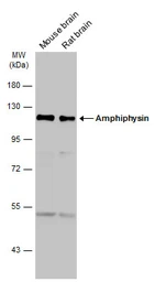Anti-Amphiphysin antibody [N1N2], N-term used in Western Blot (WB). GTX103247