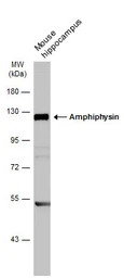 Anti-Amphiphysin antibody [N1N2], N-term used in Western Blot (WB). GTX103247
