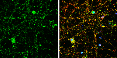 Anti-Amphiphysin antibody [N1N2], N-term used in Immunocytochemistry/ Immunofluorescence (ICC/IF). GTX103247