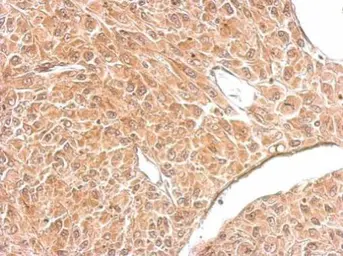 Anti-Amphiphysin antibody [N1N2], N-term used in IHC (Paraffin sections) (IHC-P). GTX103247
