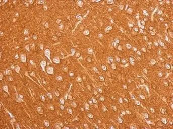 Anti-Amphiphysin antibody [N1N2], N-term used in IHC (Paraffin sections) (IHC-P). GTX103247