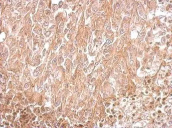 Anti-Amphiphysin antibody [N1N2], N-term used in IHC (Paraffin sections) (IHC-P). GTX103247