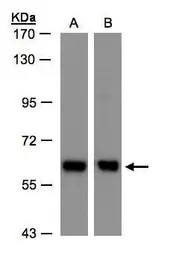 Anti-COPD antibody used in Western Blot (WB). GTX103252