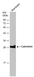 Anti-Calretinin antibody used in Western Blot (WB). GTX103261
