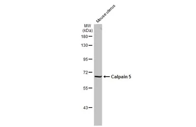Anti-Calpain 5 antibody [N1C1] used in Western Blot (WB). GTX103264