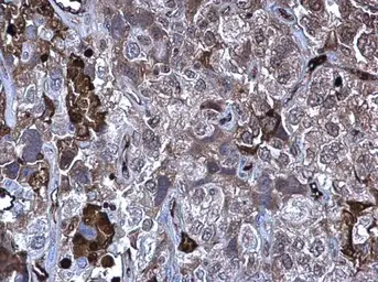 Anti-MMP10 antibody used in IHC (Paraffin sections) (IHC-P). GTX103287