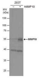 Anti-MMP10 antibody used in Western Blot (WB). GTX103287