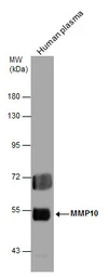 Anti-MMP10 antibody used in Western Blot (WB). GTX103287