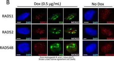 Anti-RAD54B antibody used in Immunocytochemistry/ Immunofluorescence (ICC/IF). GTX103291