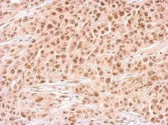 Anti-RAD54B antibody used in IHC (Paraffin sections) (IHC-P). GTX103291