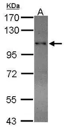 Anti-RAD54B antibody used in Western Blot (WB). GTX103291