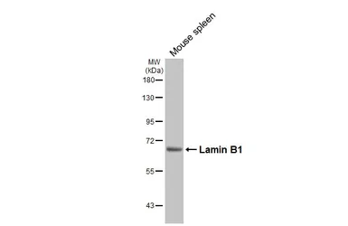 Anti-Lamin B1 antibody used in Western Blot (WB). GTX103292