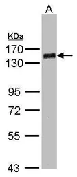 Anti-PHF20 antibody [N1N2], N-term used in Western Blot (WB). GTX103297