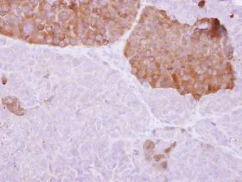 Anti-IL22 Receptor alpha 2 antibody used in IHC (Paraffin sections) (IHC-P). GTX103302