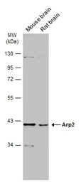 Anti-Arp2 antibody [N1C3] used in Western Blot (WB). GTX103311