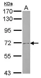 Anti-SLC4A8 antibody [N1N2], N-term used in Western Blot (WB). GTX103314