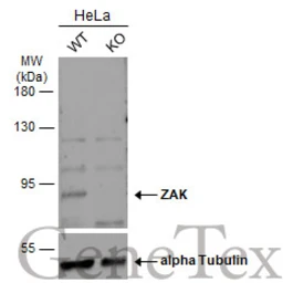 Anti-ZAK antibody [N3C2], Internal used in Western Blot (WB). GTX103317