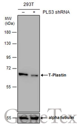 Anti-T-Plastin antibody used in Western Blot (WB). GTX103323