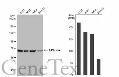 Anti-T-Plastin antibody used in Western Blot (WB). GTX103323