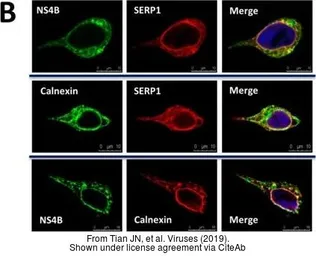 Anti-Dengue virus NS4B protein antibody used in Immunocytochemistry/ Immunofluorescence (ICC/IF). GTX103349