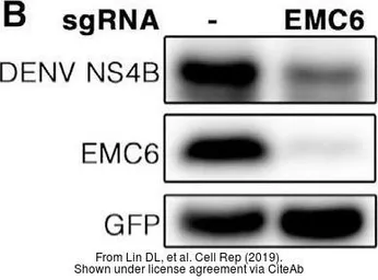Anti-Dengue virus NS4B protein antibody used in Western Blot (WB). GTX103349