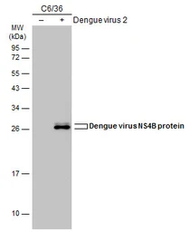 Anti-Dengue virus NS4B protein antibody used in Western Blot (WB). GTX103349