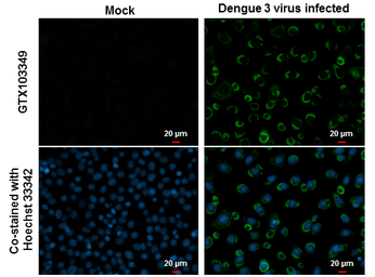 Anti-Dengue virus NS4B protein antibody used in Immunocytochemistry/ Immunofluorescence (ICC/IF). GTX103349