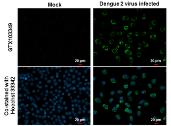 Anti-Dengue virus NS4B protein antibody used in Immunocytochemistry/ Immunofluorescence (ICC/IF). GTX103349
