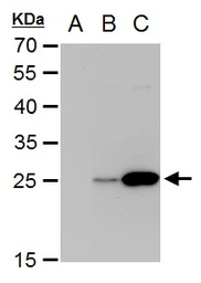 Anti-Dengue virus NS4B protein antibody used in Western Blot (WB). GTX103349