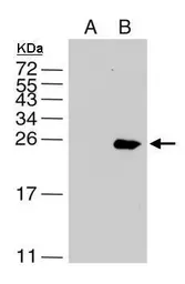 Anti-Dengue virus NS4B protein antibody used in Western Blot (WB). GTX103349