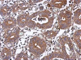Anti-PPM1J antibody used in IHC (Paraffin sections) (IHC-P). GTX103370