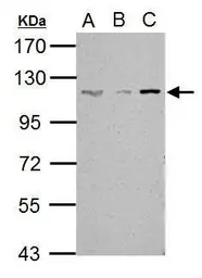 Anti-SART1 antibody [N2C1], Internal used in Western Blot (WB). GTX103371