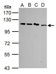 Anti-SART1 antibody [N2C1], Internal used in Western Blot (WB). GTX103371