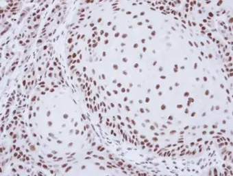 Anti-SART1 antibody [N2C1], Internal used in IHC (Paraffin sections) (IHC-P). GTX103371