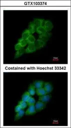 Anti-DARS antibody [N1C1] used in Immunocytochemistry/ Immunofluorescence (ICC/IF). GTX103374