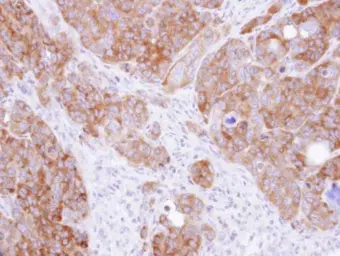 Anti-DARS antibody [N1C1] used in IHC (Paraffin sections) (IHC-P). GTX103374