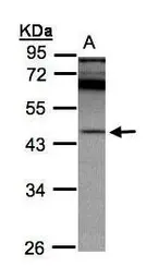 Anti-RISC antibody [N3C3] used in Western Blot (WB). GTX103381